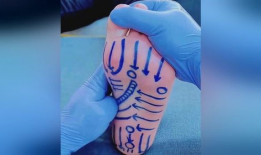 脚底按摩视频,缓解疲劳，焕发活力！